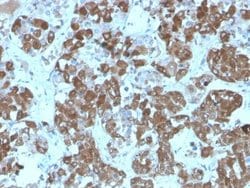 ACTH Antibody (rCLIP/1407) - Azide and BSA Free, Novus Biologicals 100 &mu;g | Buy Online | Novus Biologicals | Fisher Scientific